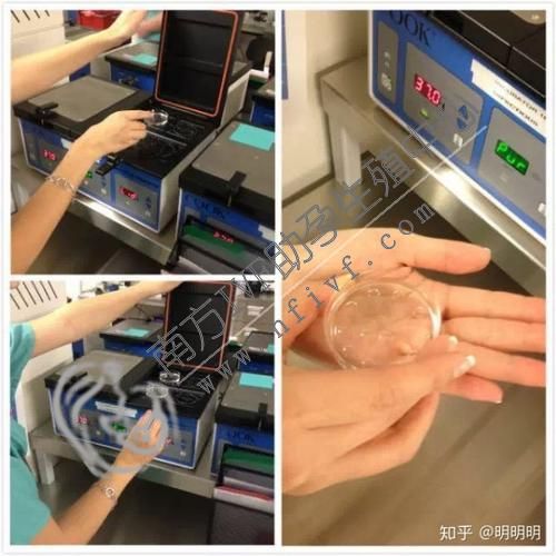 杭州正规借卵流程_杭州市第一人民医院试管婴儿怎么挂号